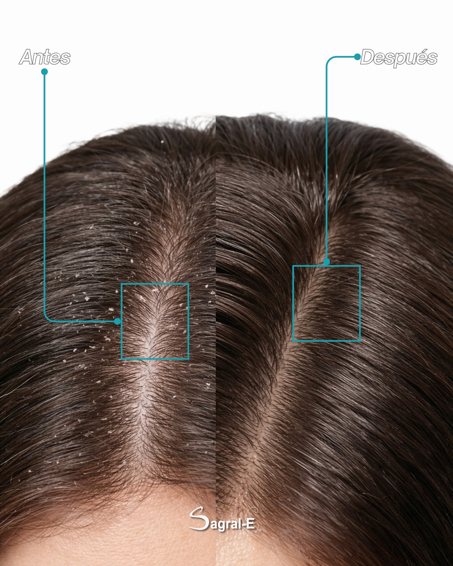 Shampoo Limpieza Profunda Paso 1